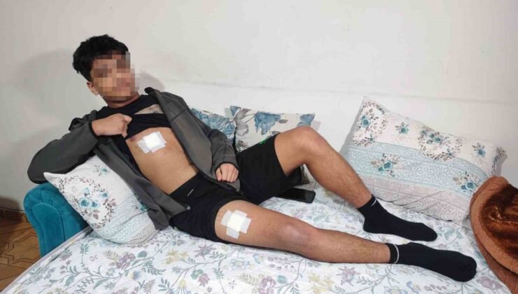 Akran zorbalığı az kalsın öldürüyordu: Önce dövüldü sonra bıçaklandı