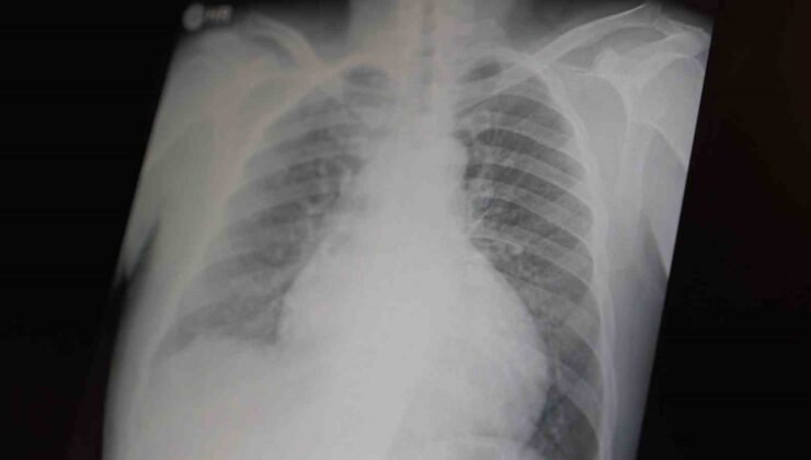 Profesör açıkladı: “Metamfetamin ve kokain gençler arasında tehlikeli boyutlara ulaştı”