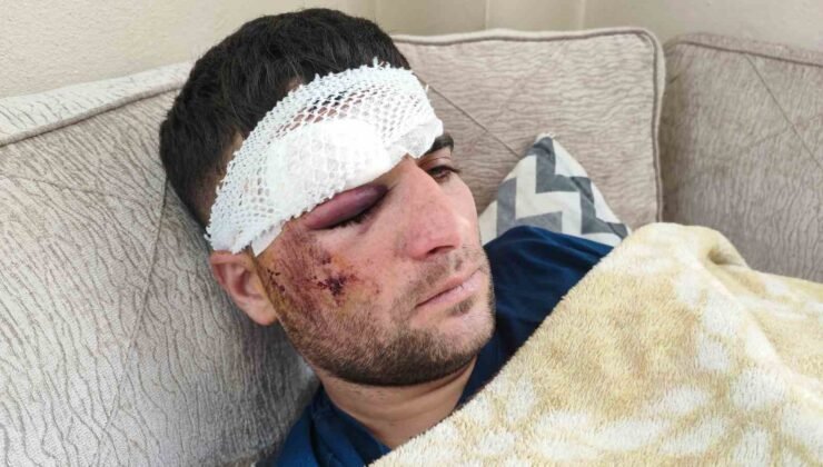 Döner ustası motosiklet sürücüsü: “Kaza sonrası kaçıp gittiler”