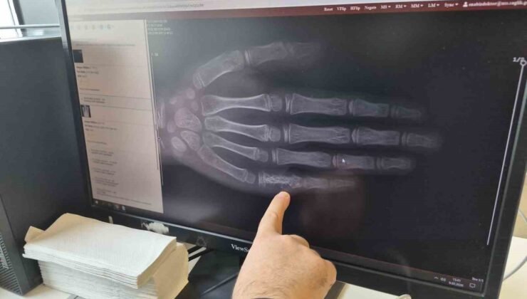 Eskişehir’de her ay 5 ila 7 çocuğa kanser tanısı konuluyor