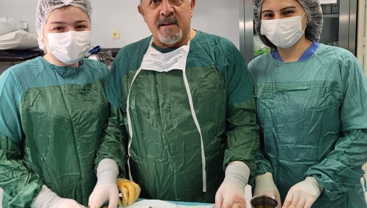 Karın ağrısıyla gitti, safrasından binlerce taş çıktı