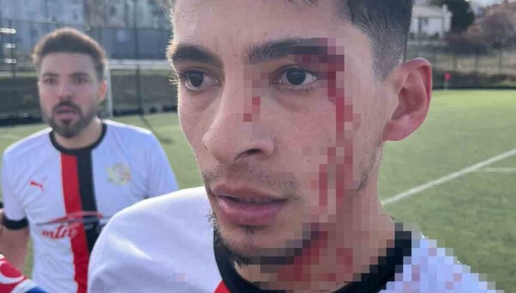 Maç sonrası saha içi savaş alanına döndü, 3 futbolcu hastanelik oldu