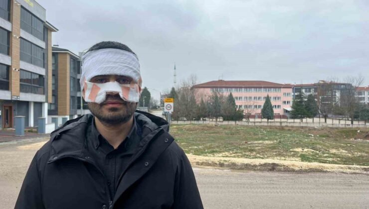 Rehber öğretmenin yüzüne sıcak çay fırlattığı fizik öğretmeni feci şekilde yandı