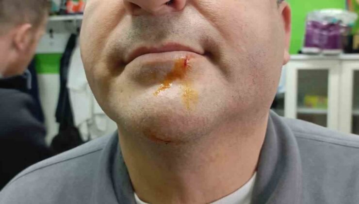 Zonguldak’ta 3. Lig maçı sonrası gerginlik: 2 gazeteci darbedildi, 2 polis yaralandı