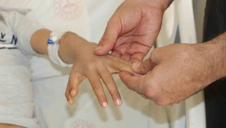 Şırnak’ta yapışık parmaklı iki kardeş ameliyatla sağlıklarına kavuştu